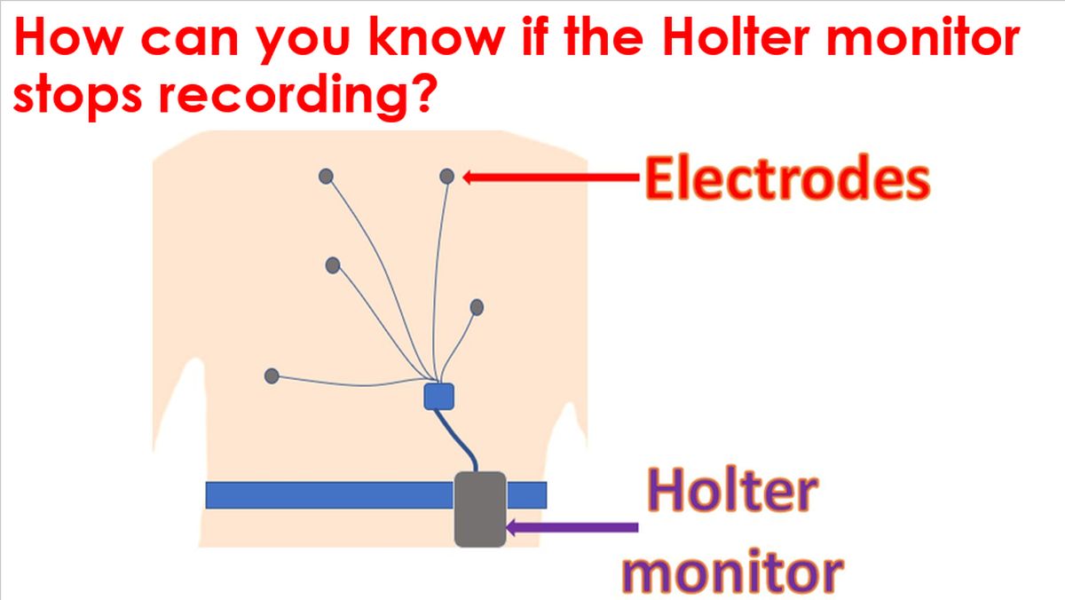 How Can You Know If The Holter Monitor Stops Recording All About