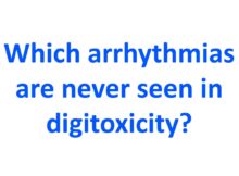 Which arrhythmias are never seen in digitoxicity