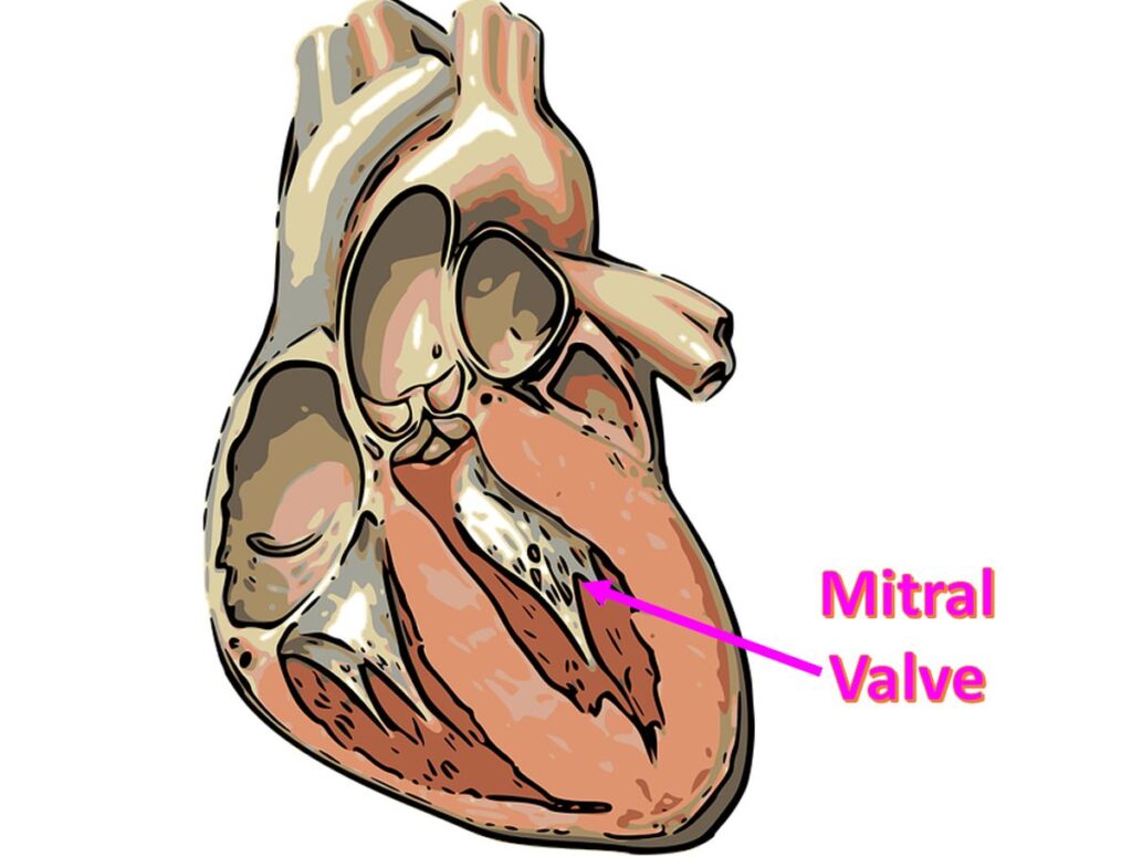 Rheumatic Fever – All About Heart And Blood Vessels