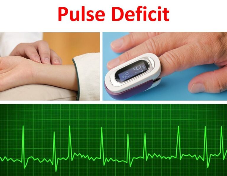 pulse-deficit-all-about-heart-and-blood-vessels