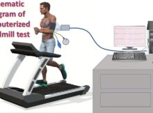 Schematic diagram of computerized treadmill test