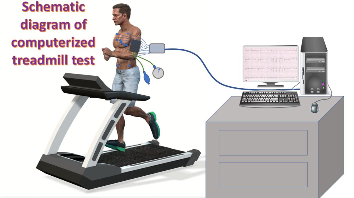 Schematic diagram of computerized treadmill test