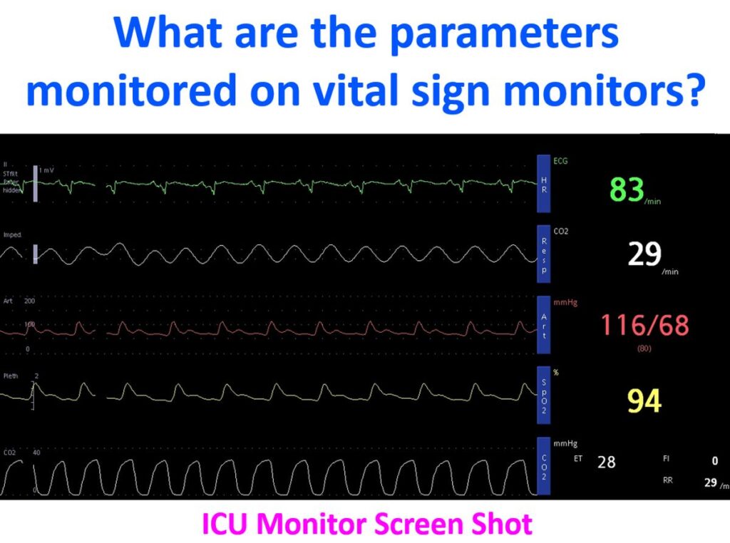 What are the parameters monitored on vital sign monitors