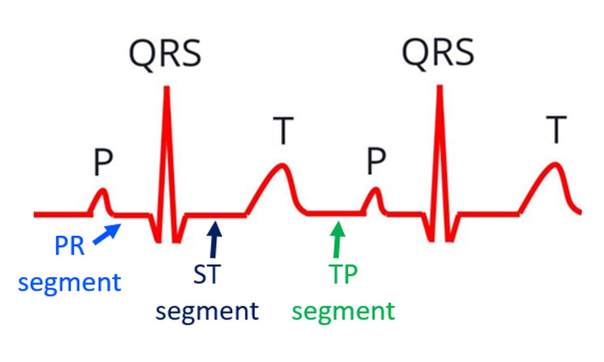 ECG Waveform Explained: EKG Labeled Diagrams And Components, 42% OFF