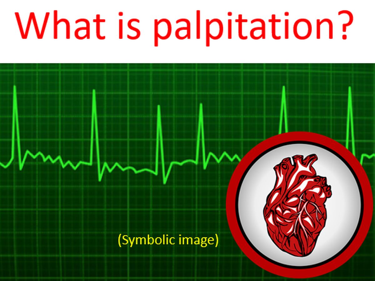 palpitation