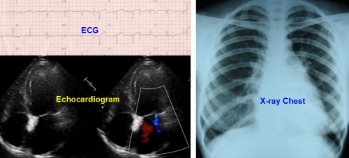 Evaluation of heart function