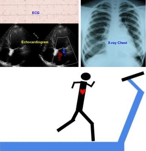 Tests for heart disease – All About Heart And Blood Vessels