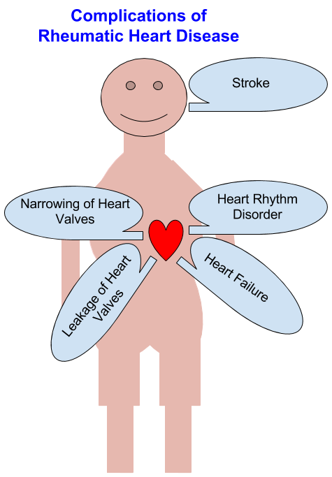 Rhuematic heart disease - All About Heart And Blood Vessels