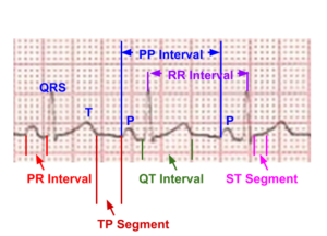 Segments and intervals in an electrocardiogram