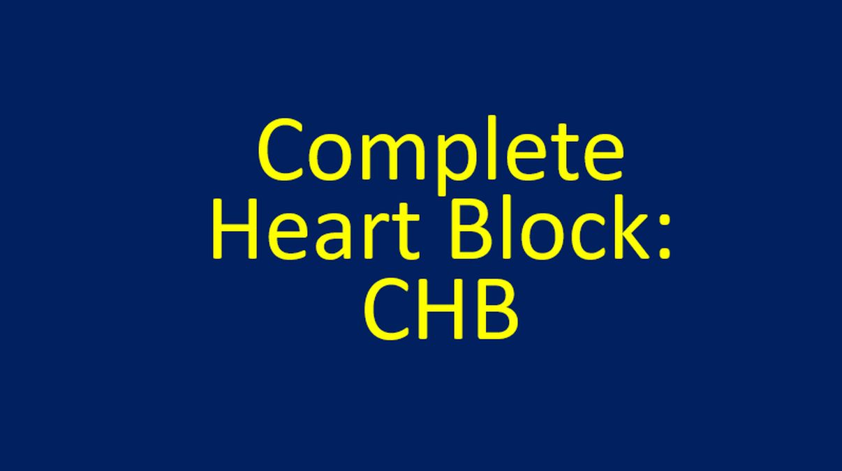 complete-heart-block-chb