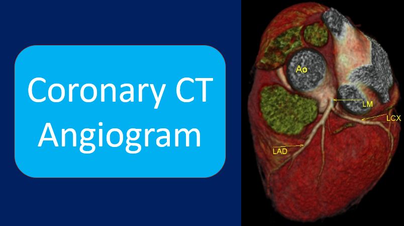 Coronary CT Angiogram