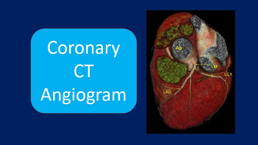 Coronary CT Angiogram