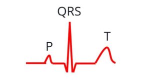 Simplified Explanation Of Ecg Changes In A Heart Attack – All About 