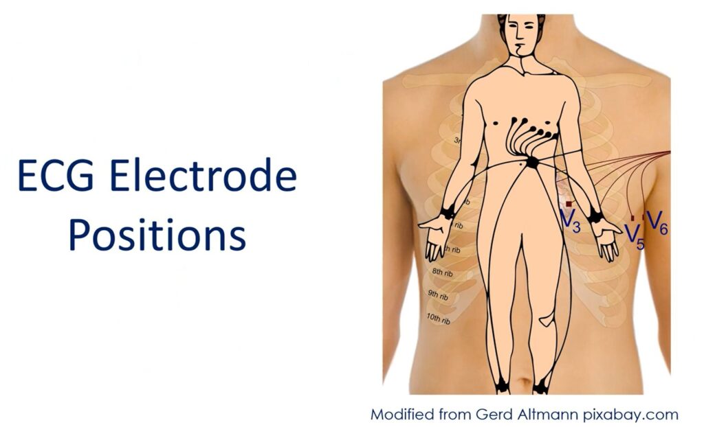ECG electrode positions