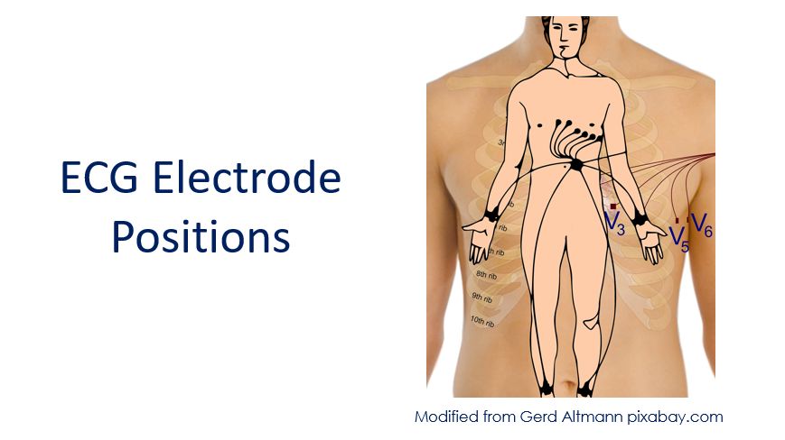 ECG electrode positions