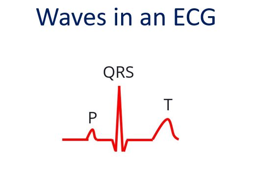 Waves in an ECG
