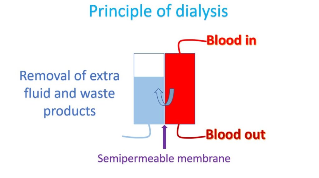 Principle of dialysis