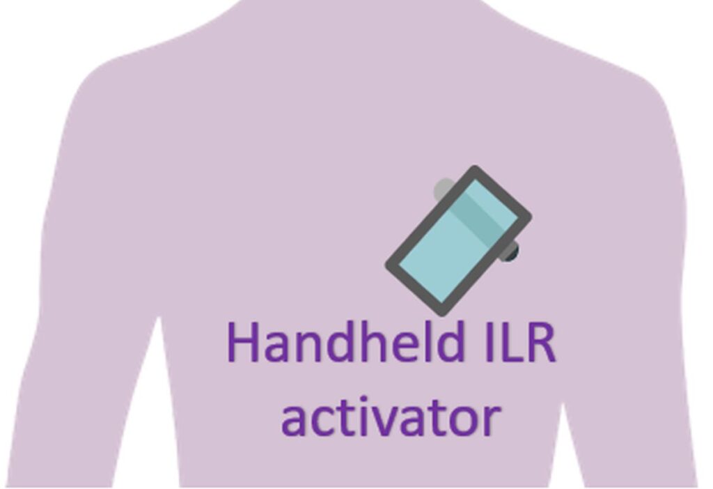 Handheld ILR activator