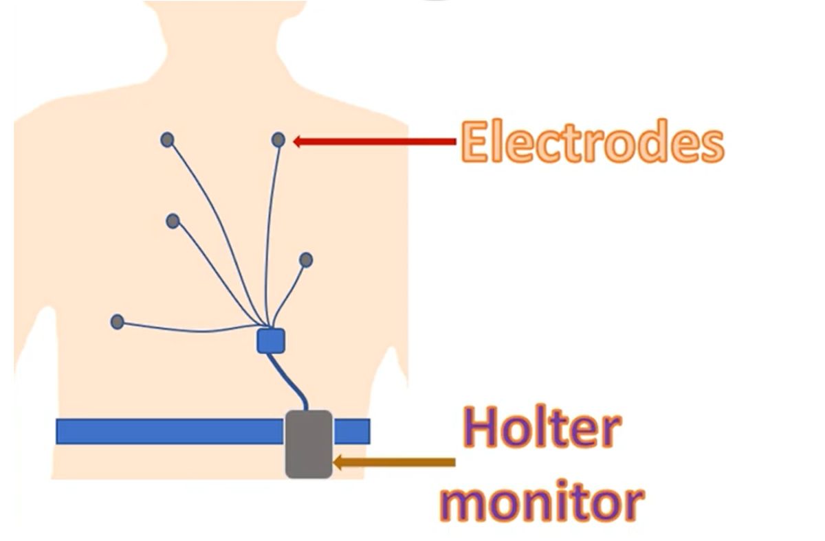 How to prepare for an ECG holter?