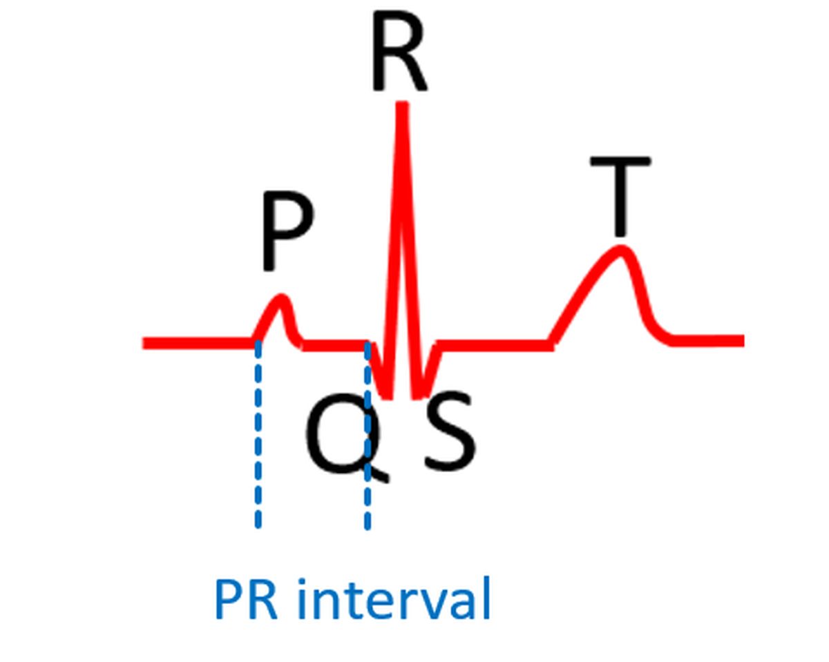 what-are-the-normal-values-for-ecg-measurements-all-about-heart-and