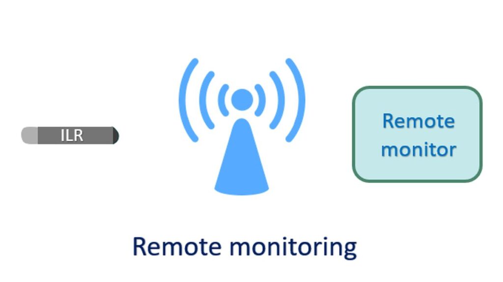 Remote monitoring of ILR