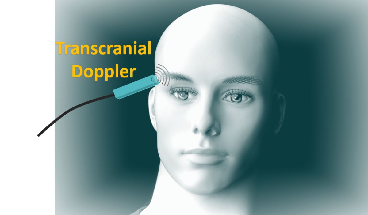Transcranial Doppler