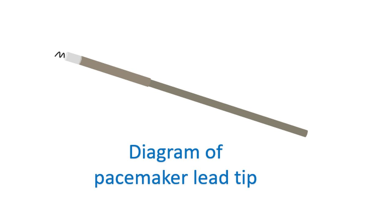 Diagram pacemaker lead tip