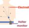 Holter monitor diagram