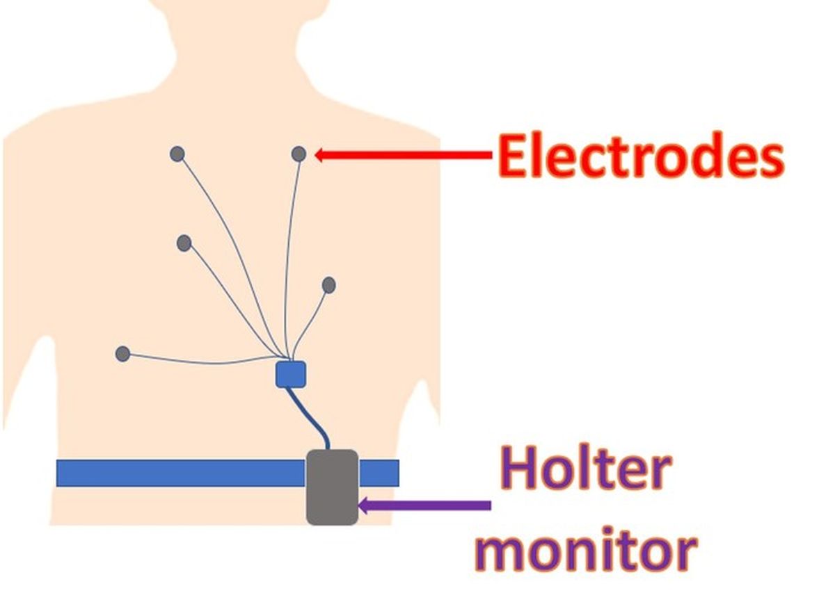Holter monitor diagram
