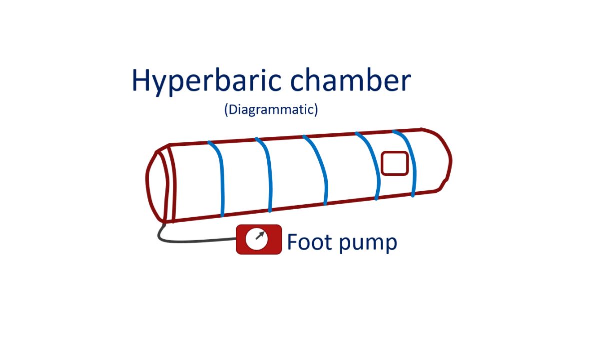 Hyperbaric chamber (Diagrammatic)