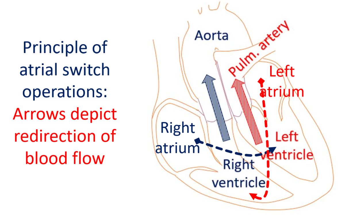 Principle of atrial switch operations