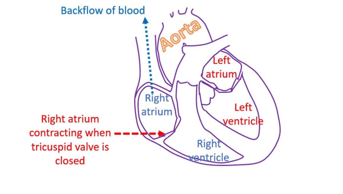 Right atrium contracting against closed tricuspid valve, back flow of blood from right atrium