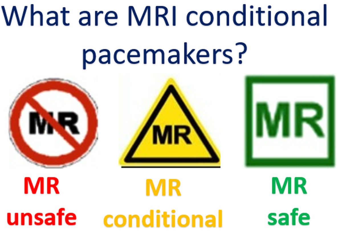 What are MRI conditional pacemakers