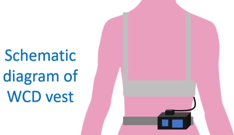 What Is A Wearable Cardioverter Defibrillator (WCD)? – All About Heart ...