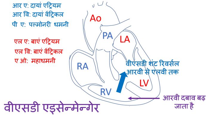 वीएसडी एइसेन्मेन्गेर