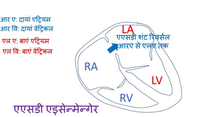 एएसडी एइसेन्मेन्गेर