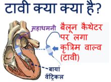 टावी क्या क्या है