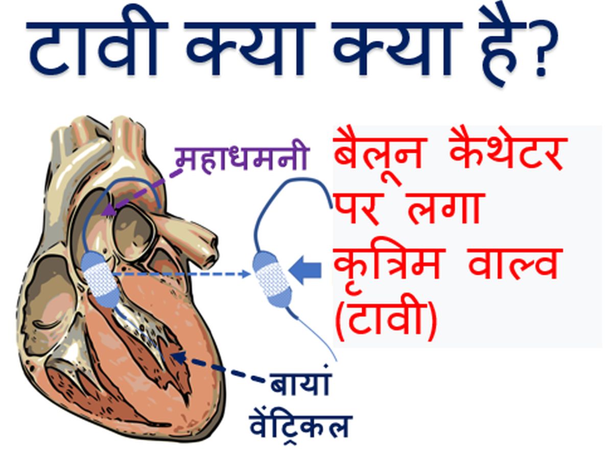 टावी क्या क्या है