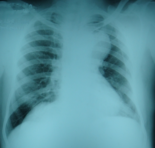 Cardiology X-ray Quiz
