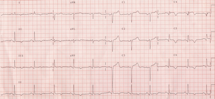 old-awmi-all-about-cardiovascular-system-and-disorders