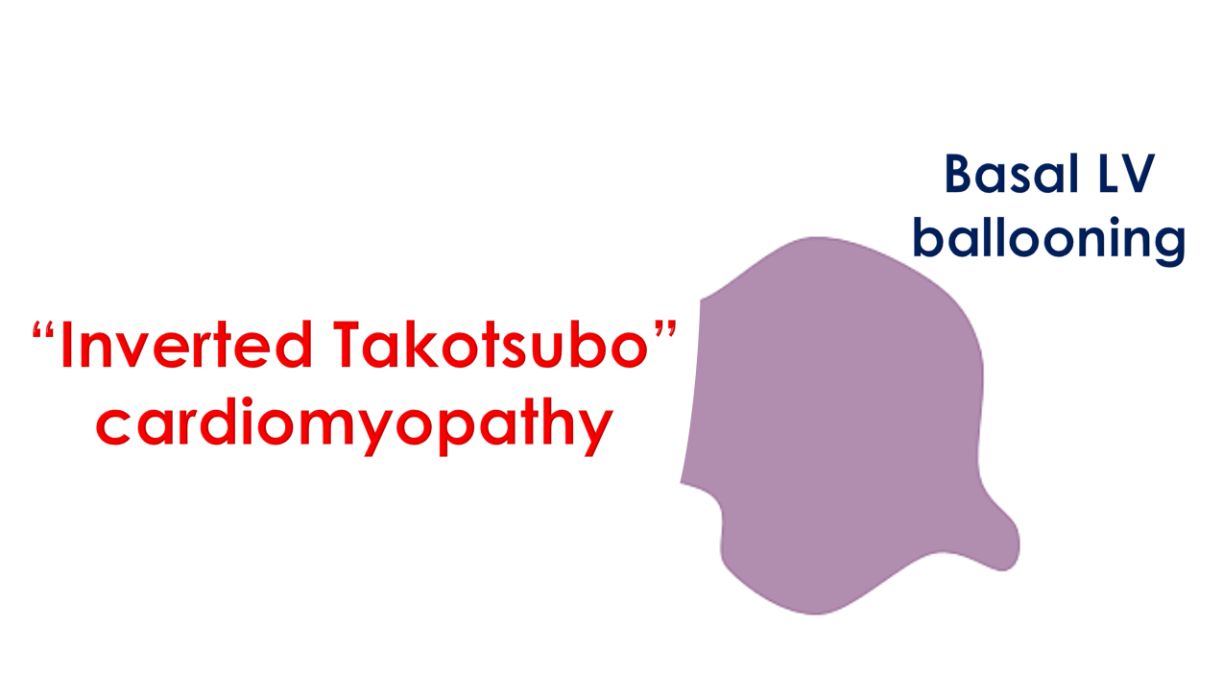 Basal LV ballooning in inverted Takotsubo cardiomyopathy