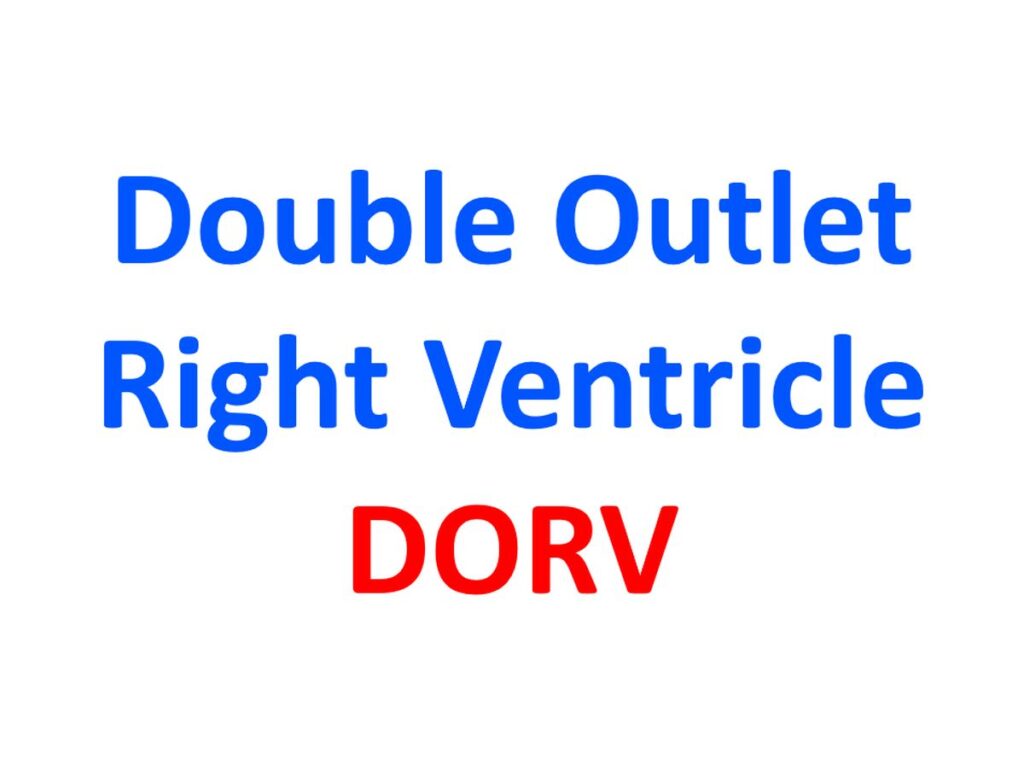 Double outlet right ventricle (DORV)