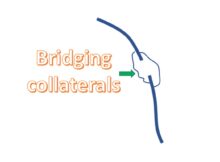 Bridging collaterals