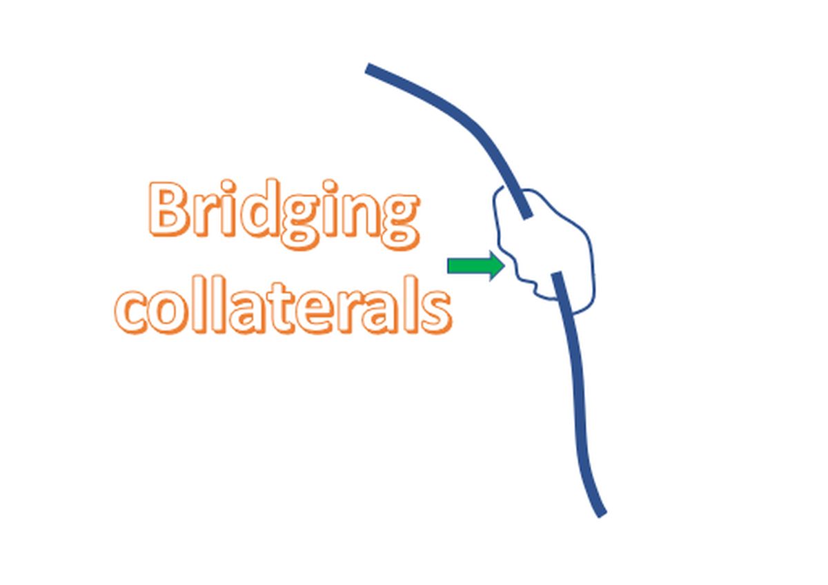 Bridging collaterals