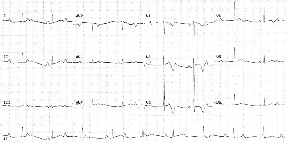 ECG Quiz 2