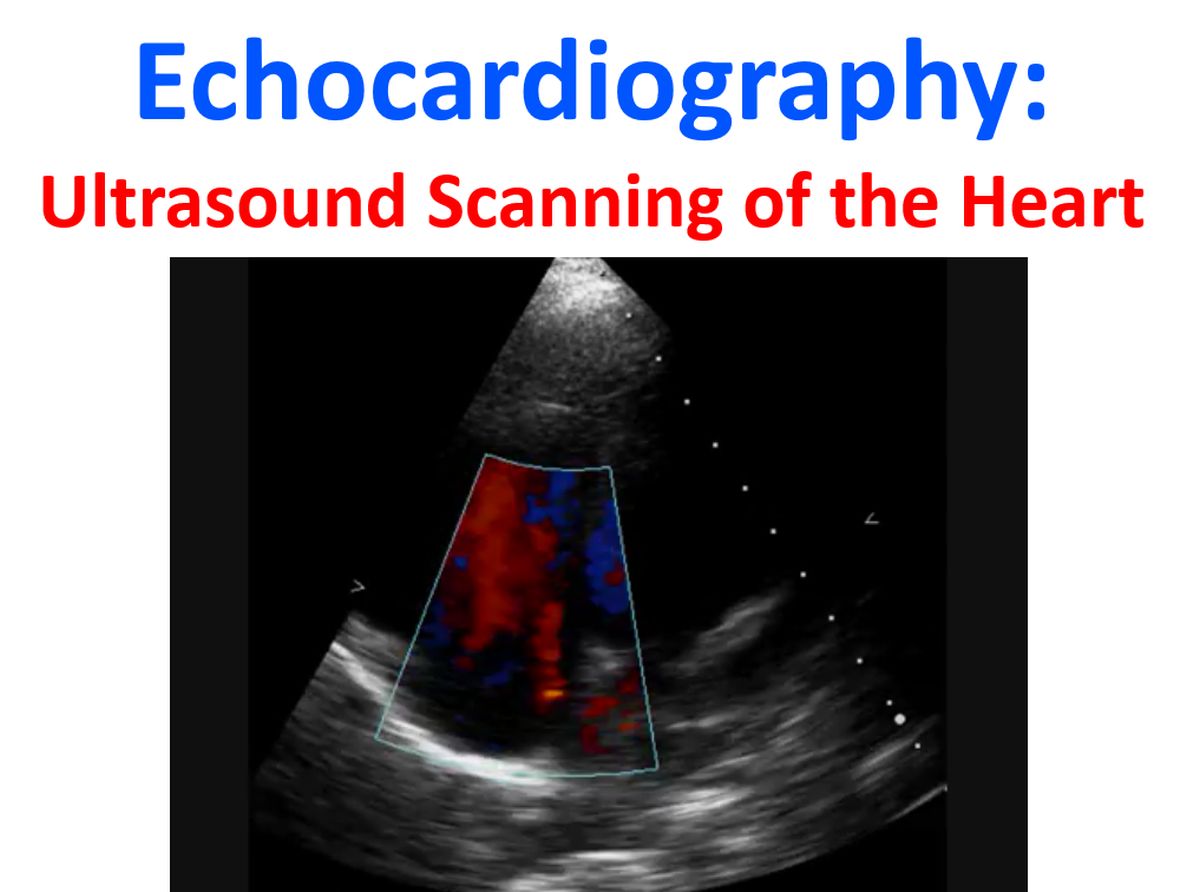 echocardiogram heart ultrasound vs