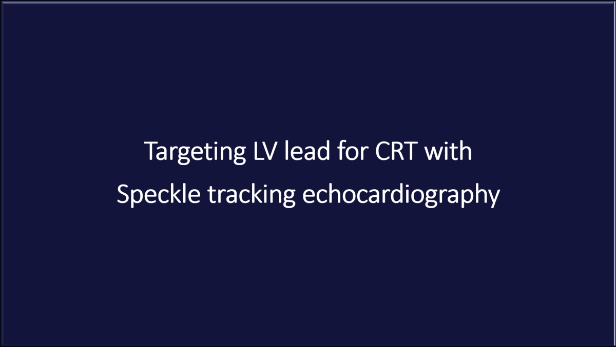 Targeting LV lead for CRT with speckle tracking echocardiography