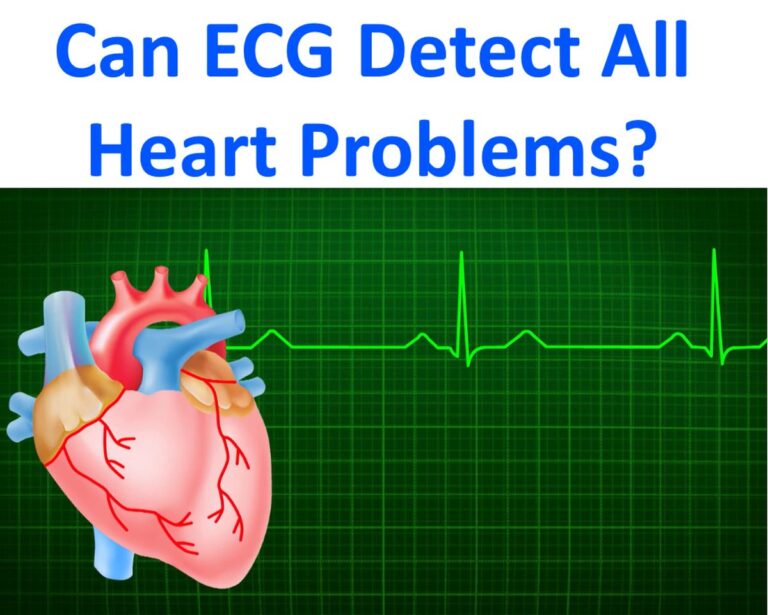 Can ECG detect all heart problems? – All About Cardiovascular System ...