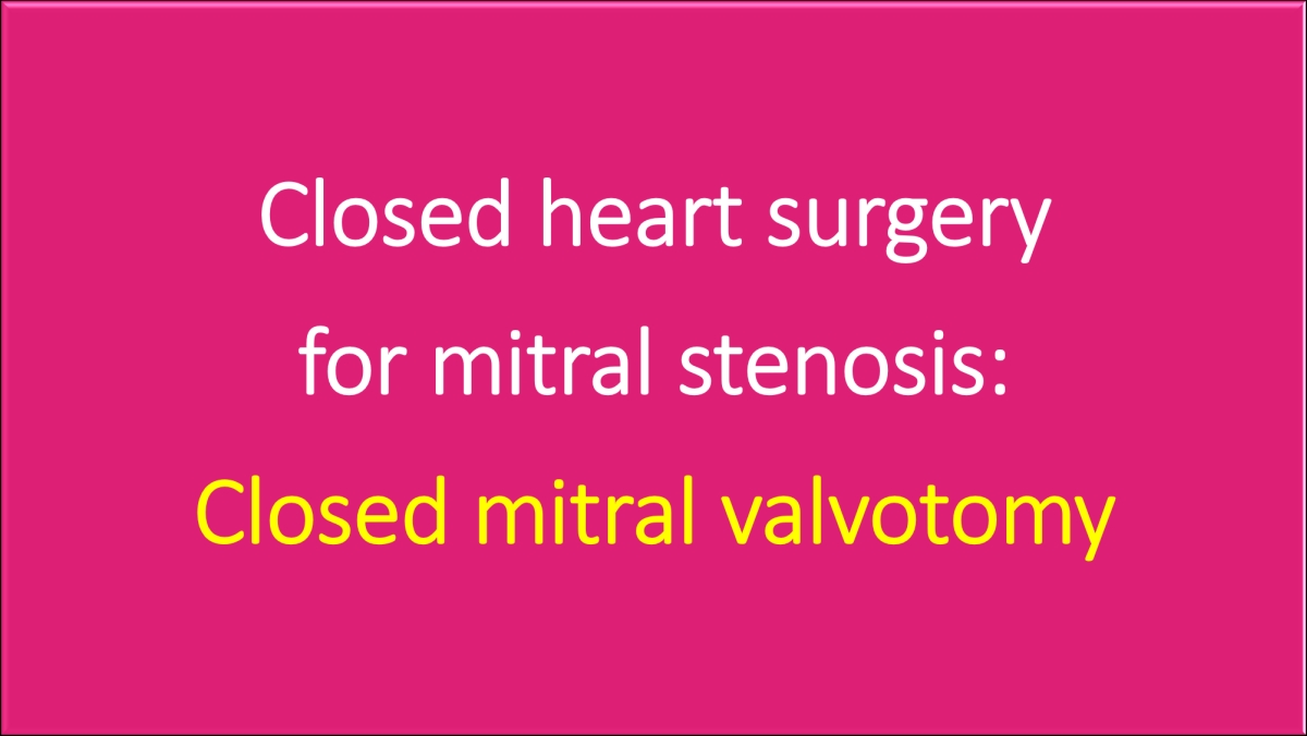 Closed heart surgery for mitral stenosis (closed mitral valvotomy)