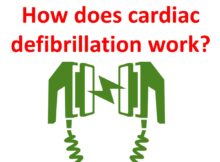 How does cardiac defibrillation work